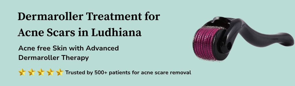 Dermaroller Treatment Banner