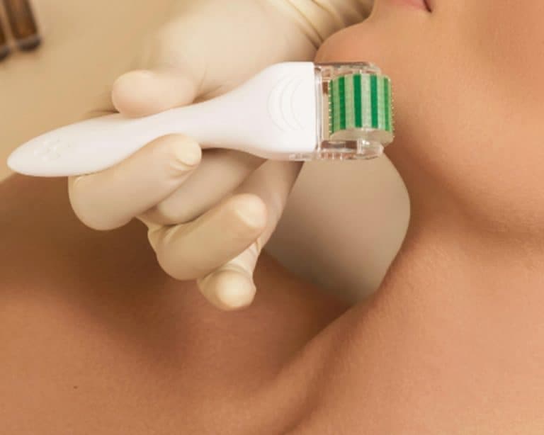 Dermaroller Preparation at Puri Skin Clinic