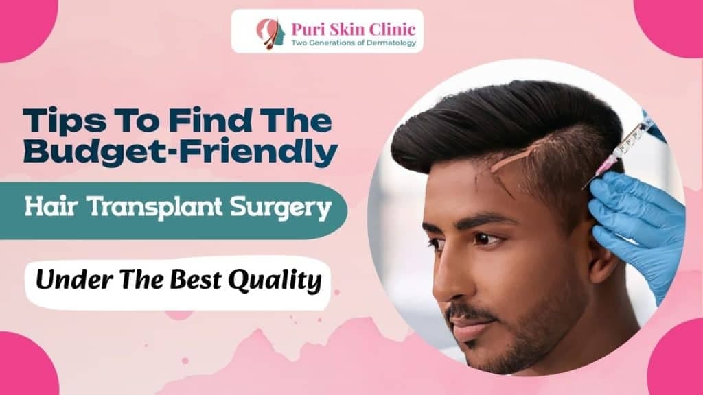 Tips To Find The Budget-Friendly Hair Transplant Surgery Under The Best Quality