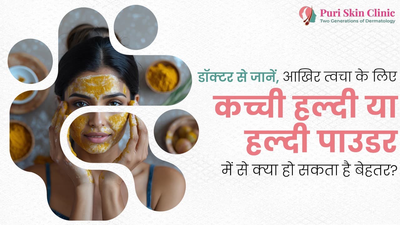डॉक्टर से जानें, आखिर त्वचा के लिए कच्ची हल्दी या हल्दी पाउडर में से क्या हो सकता है बेहतर?