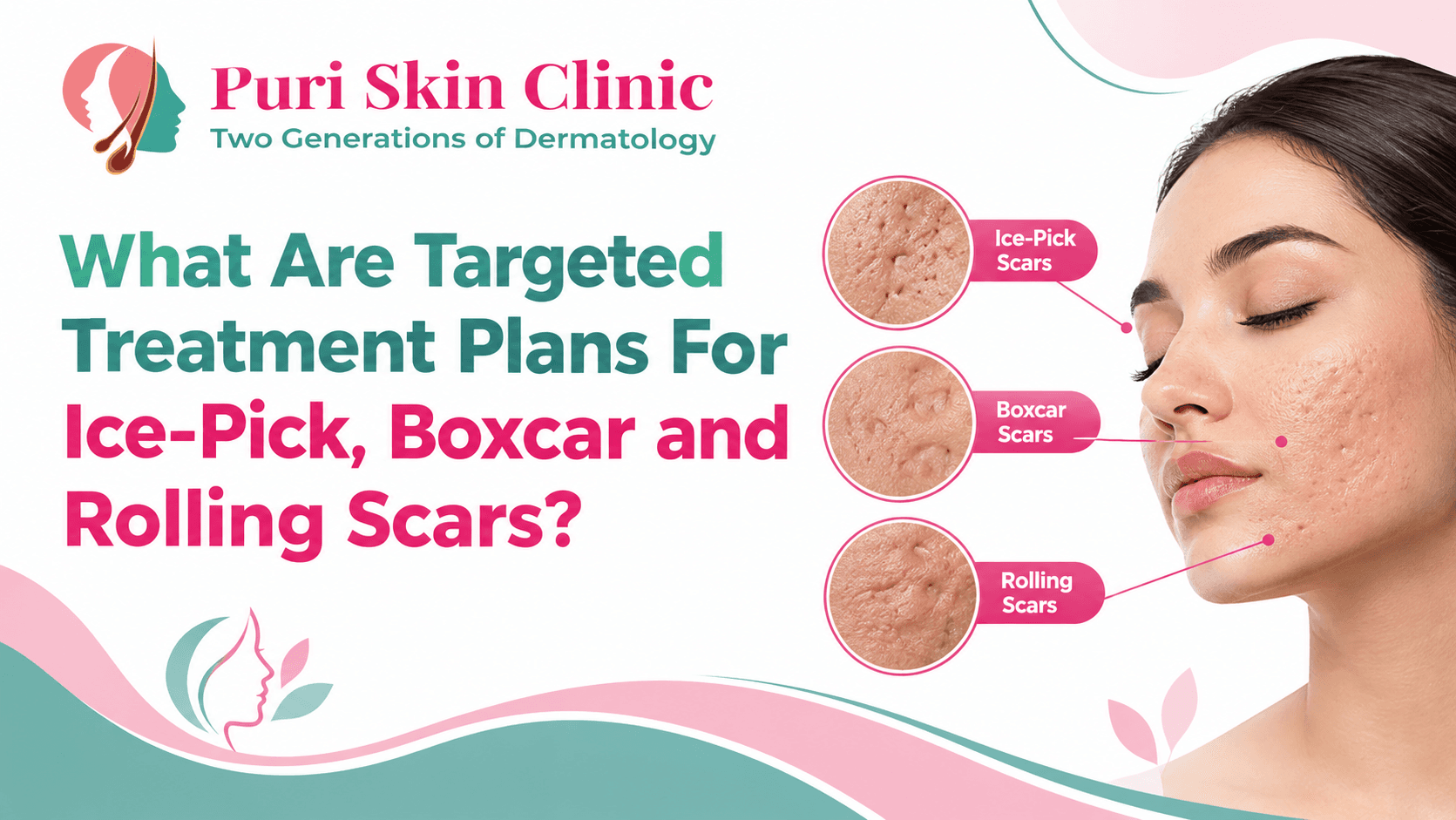 What Are Targeted Treatment Plans For Ice-Pick, Boxcar and Rolling Scars?