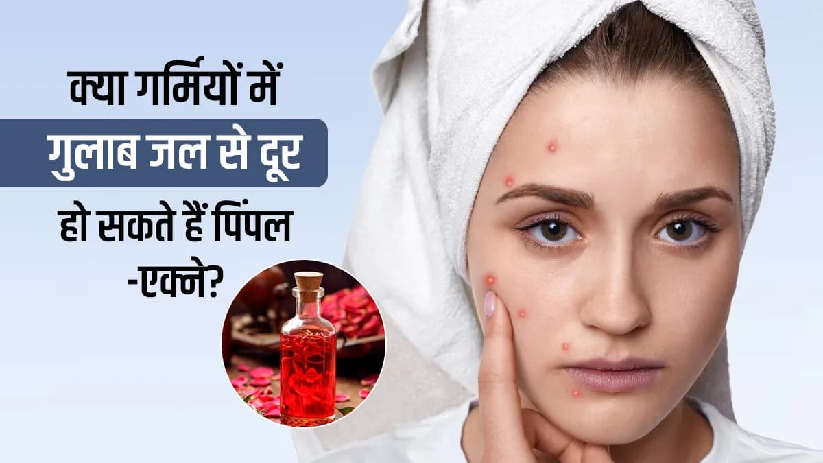 क्या गर्मी में बढ़ते दाग-धब्बों को दूर करने के लिए इन उपायों को अपनाना हो सकता है फायदेमंद? डॉक्टर से जानें इसके बारे में!