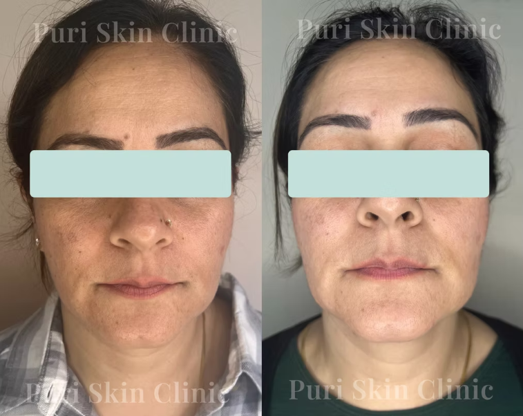 Client results